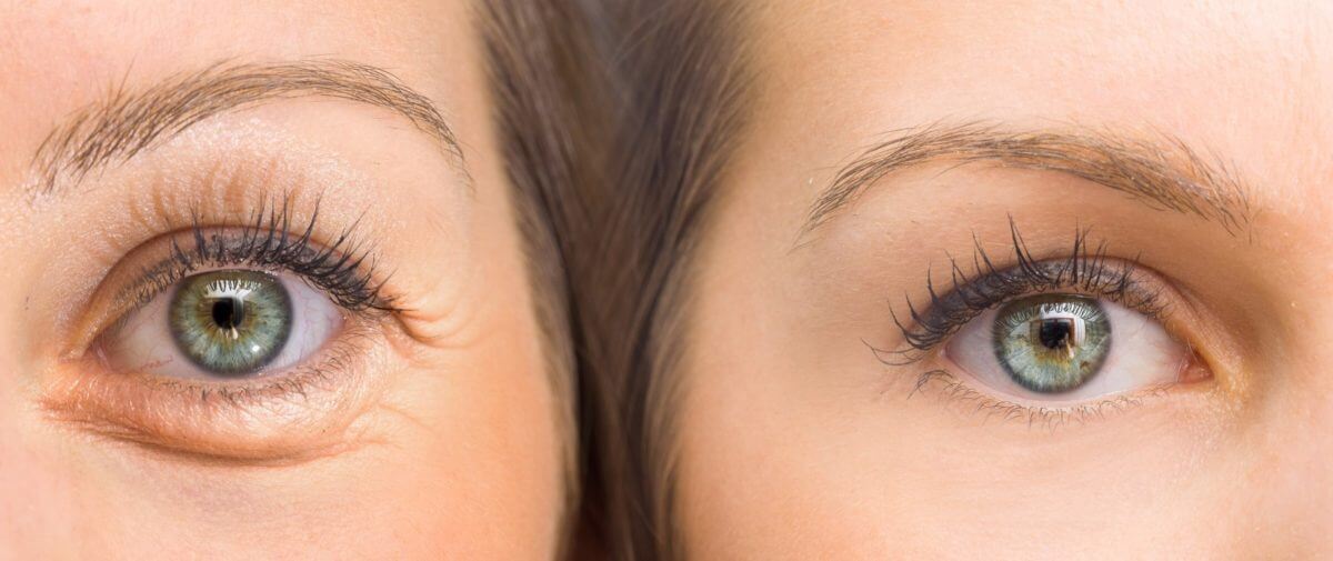 Colágeno: el componente secreto para mantener tu rostro joven por siempre